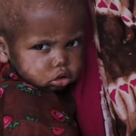 Somalie, 730 enfants sont morts de faim dans les centres alimentaires de l’ONU